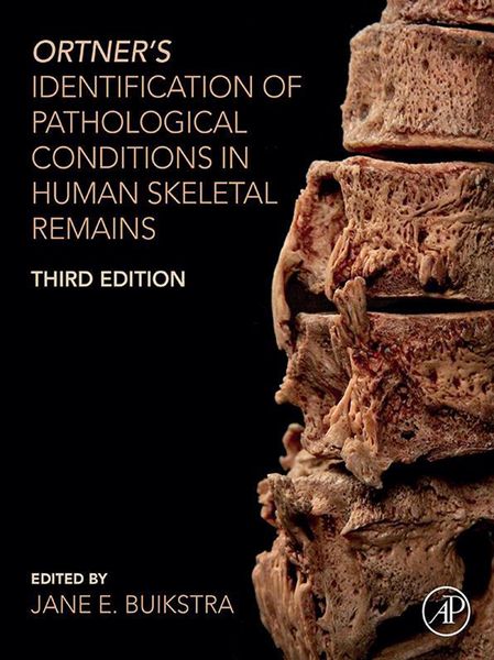 Produktbild: Ortner's Identification of Pathological Conditions in Human Skeletal Remains