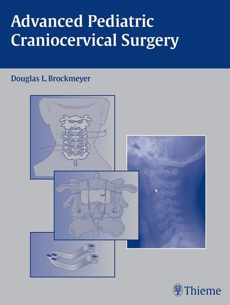 Produktbild: Advanced Pediatric Craniocervical Surgery