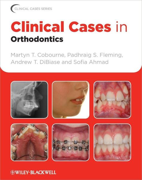 Produktbild: Clinical Cases in Orthodontics
