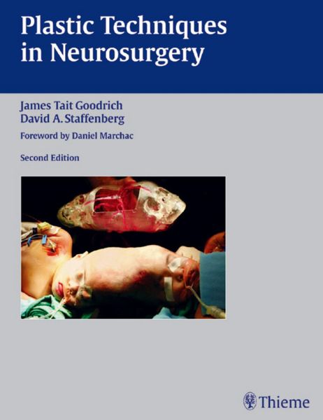 Produktbild: Plastic Techniques in Neurosurgery