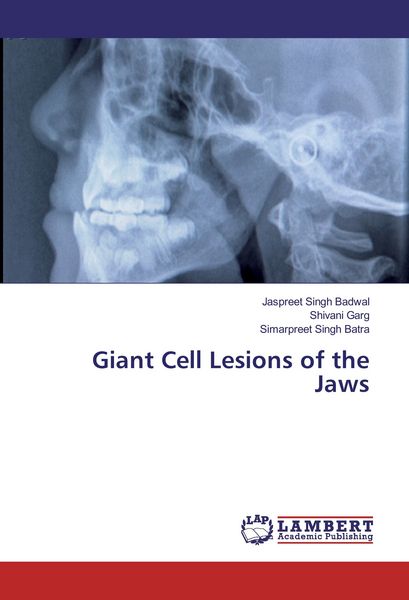 Produktbild: Giant Cell Lesions of the Jaws