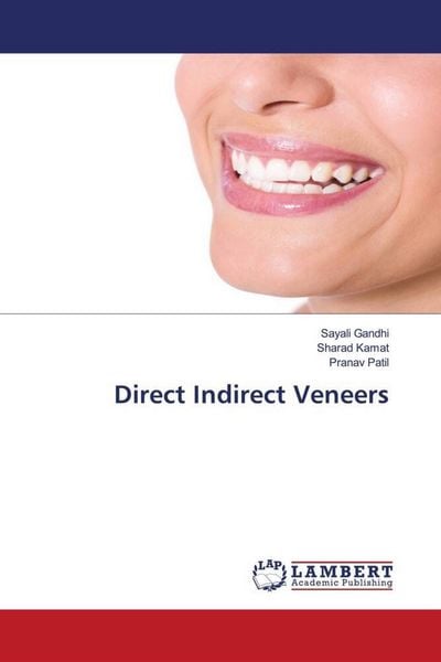 Produktbild: Direct Indirect Veneers