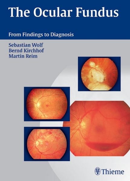 Produktbild: The Ocular Fundus