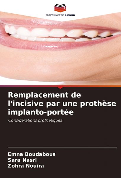 Produktbild: Remplacement de l'incisive par une proth&egrave;se implanto-port&eacute;e