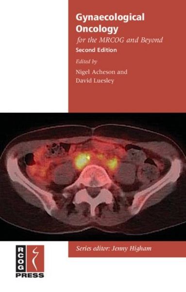 Produktbild: Gynaecological Oncology for the MRCOG and Beyond