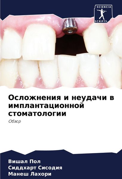 Produktbild: Oslozhneniq i neudachi w implantacionnoj stomatologii