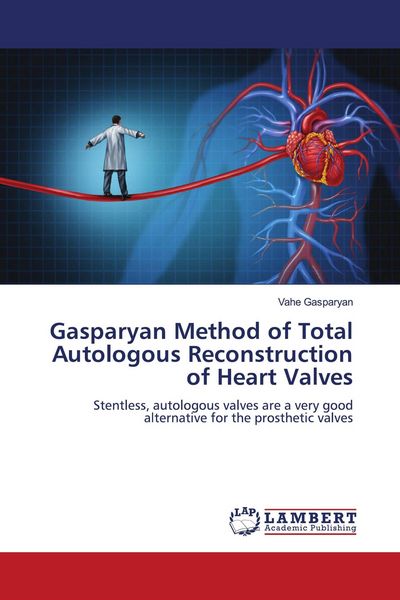 Produktbild: Gasparyan Method of Total Autologous Reconstruction of Heart Valves