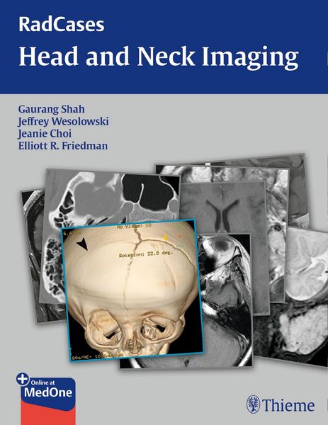 Produktbild: RadCases Head and Neck Imaging