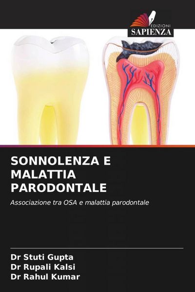 Produktbild: Sonnolenza E Malattia Parodontale