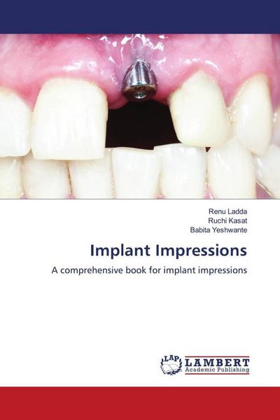 Produktbild: Implant Impressions