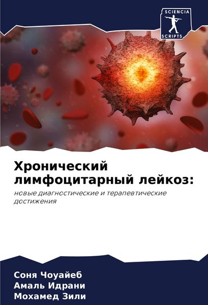 Produktbild: Hronicheskij limfocitarnyj lejkoz: