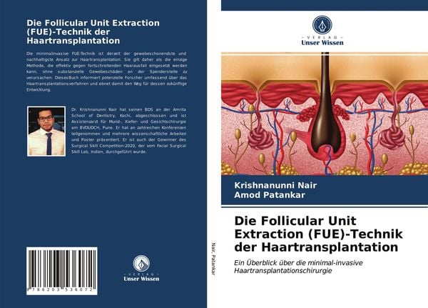 Die Follicular Unit Extraction (FUE)-Technik der Haartransplantation, Taschenbuch von Krishnanunni Nair , Amod Patankar, Verlag Unser Wissen,