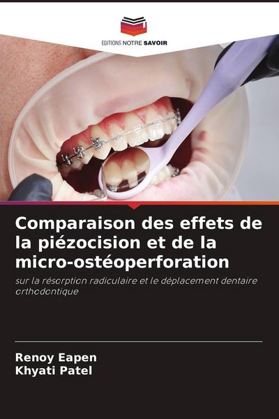 Produktbild: Comparaison des effets de la pi&eacute;zocision et de la micro-ost&eacute;operforation
