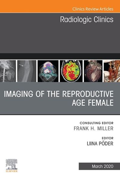 Produktbild: Imaging of the Reproductive Age Female,An Issue of Radiologic Clinics of North America