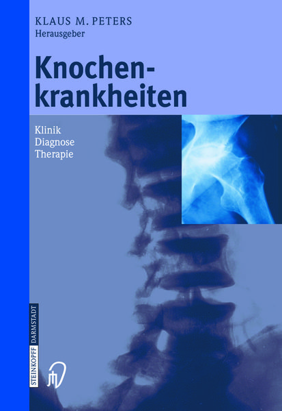 Produktbild: Knochenkrankheiten