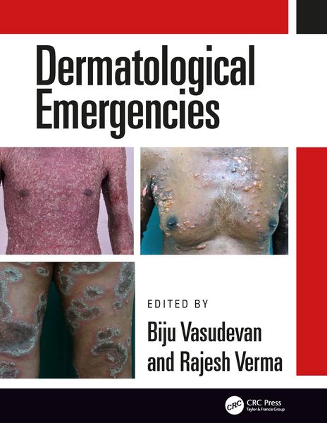 Produktbild: Dermatological Emergencies