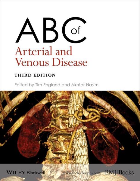 Produktbild: ABC of Arterial and Venous Disease