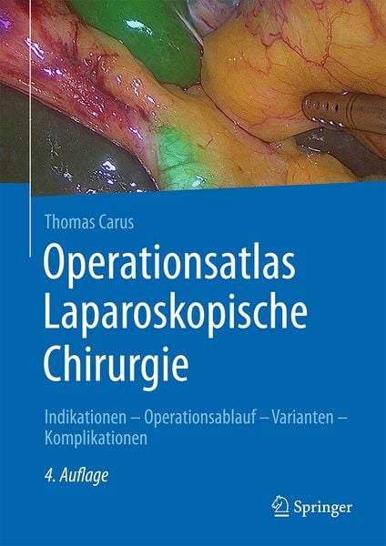 Produktbild: Operationsatlas Laparoskopische Chirurgie