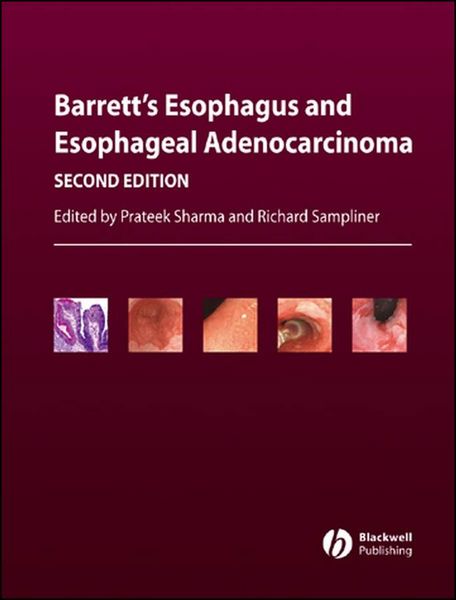 Produktbild: Barrett's Esophagus and Esophageal Adenocarcinoma