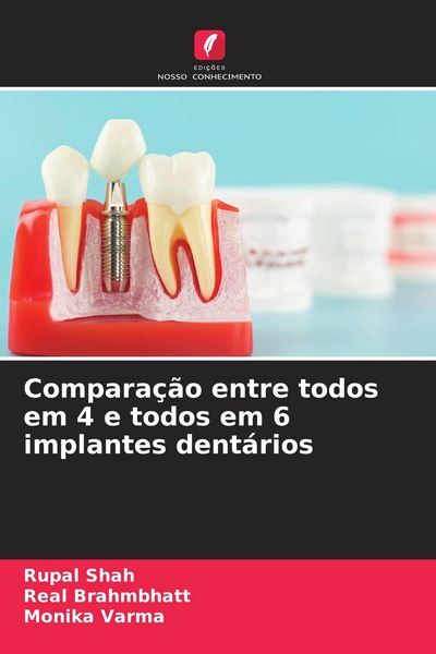 Produktbild: Compara&ccedil;&atilde;o entre todos em 4 e todos em 6 implantes dent&aacute;rios