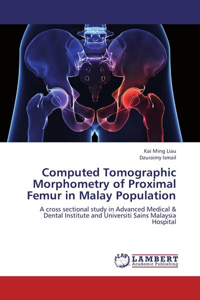 Produktbild: Computed Tomographic Morphometry of Proximal Femur in Malay Population