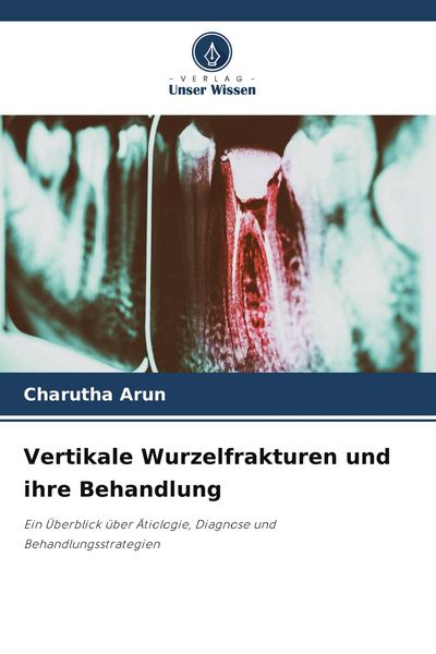 Produktbild: Vertikale Wurzelfrakturen und ihre Behandlung