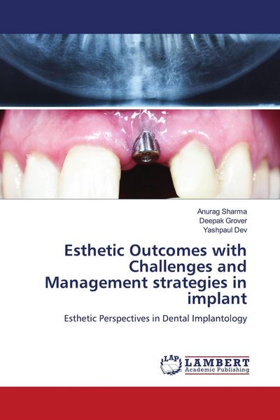 Produktbild: Esthetic Outcomes with Challenges and Management strategies in implant