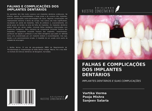 Produktbild: Falhas E Complica&ccedil;&otilde;es Dos Implantes Dent&aacute;rios