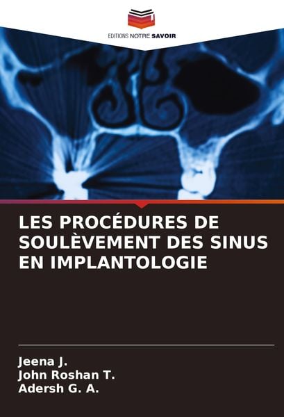 Produktbild: Les Proc&eacute;dures De Soul&egrave;vement des Sinus En Implantologie