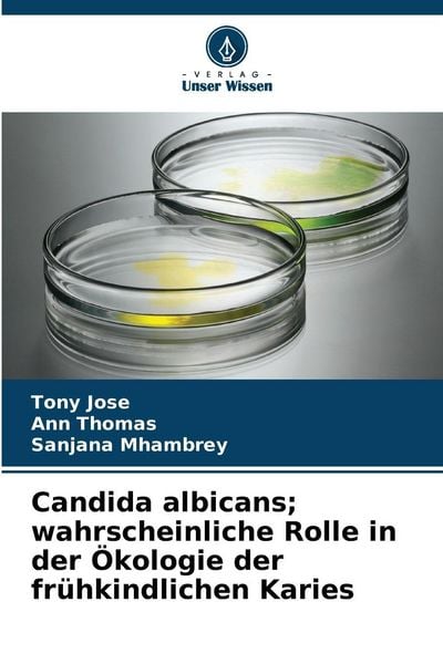 Candida albicans; wahrscheinliche Rolle in der Ökologie der frühkindlichen Karies, Taschenbuch von Tony Jose , Ann Thomas , Sanjana Mhambrey, Verlag