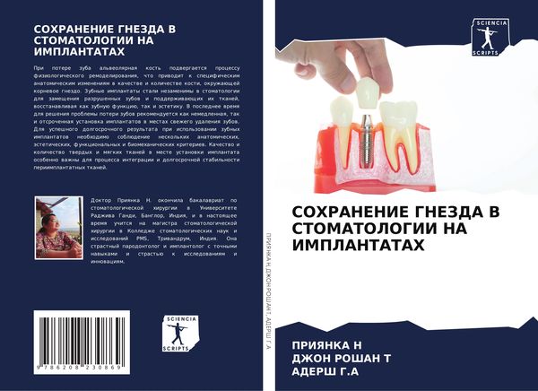 Produktbild: Sohranenie Gnezda V Stomatologii Na Implantatah