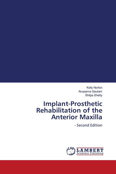 Produktbild: Implant-Prosthetic Rehabilitation of the Anterior Maxilla