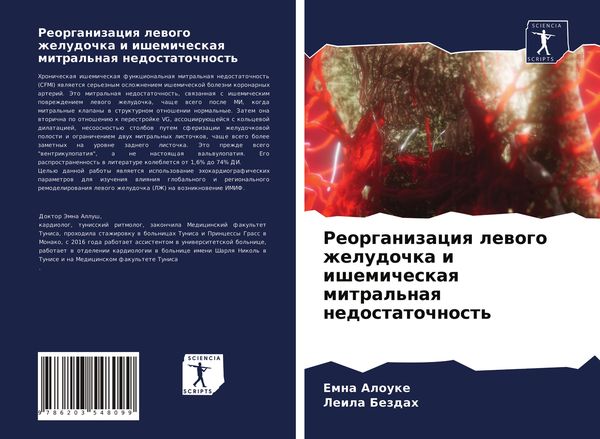 Produktbild: Reorganizaciq lewogo zheludochka i ishemicheskaq mitral'naq nedostatochnost'