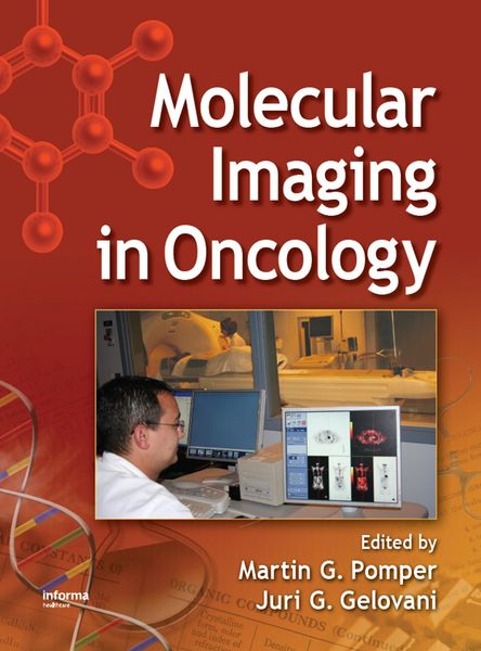 Produktbild: Molecular Imaging in Oncology