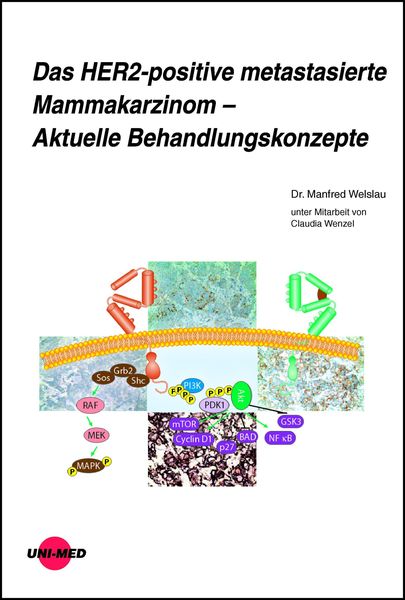 Produktbild: Das HER2-positive metastasierte Mammakarzinom - Aktuelle Behandlungskonzepte