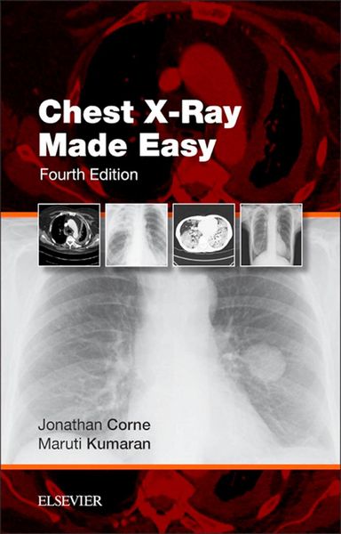 Produktbild: Chest X-Ray Made Easy E-Book