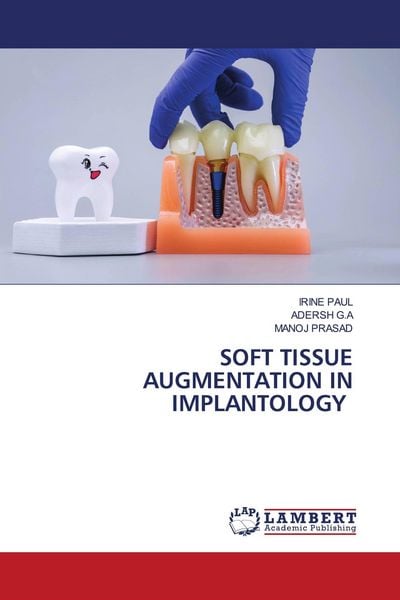 Produktbild: SOFT TISSUE AUGMENTATION IN IMPLANTOLOGY