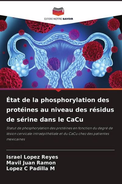Produktbild: &Eacute;tat de la phosphorylation des prot&eacute;ines au niveau des r&eacute;sidus de s&eacute;rine dans le CaCu