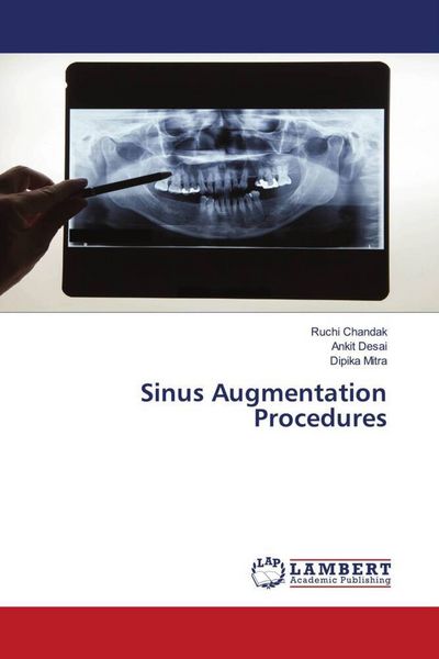 Produktbild: Sinus Augmentation Procedures