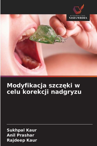 Produktbild: Modyfikacja szcz&iquest;ki w celu korekcji nadgryzu