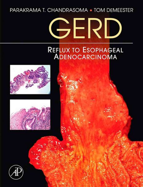 Produktbild: Gerd