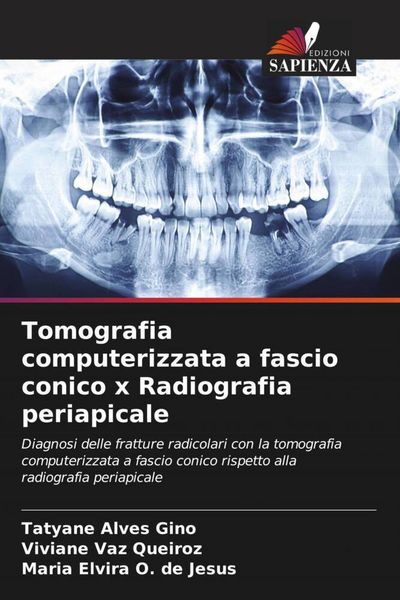 Produktbild: Tomografia computerizzata a fascio conico x Radiografia periapicale