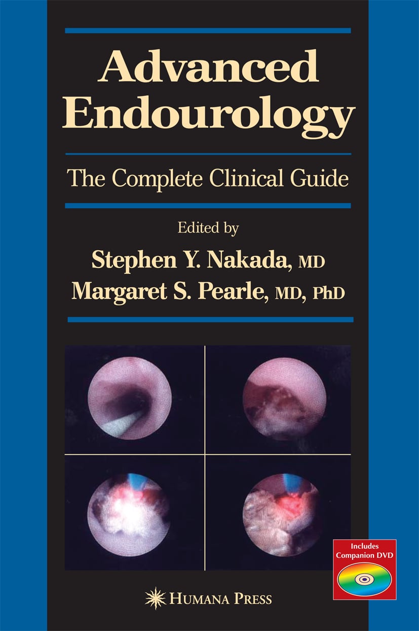 Produktbild: Advanced Endourology