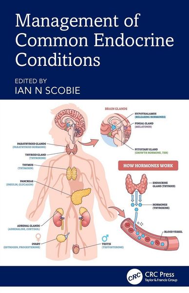 Produktbild: Management of Common Endocrine Conditions