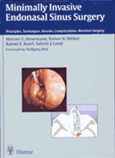 Produktbild: Minimally Invasive Endonasal Sinus Surgery