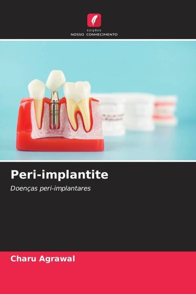 Produktbild: Peri-implantite