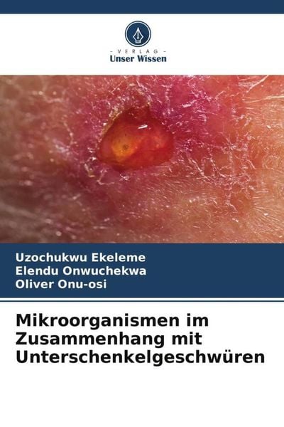 Produktbild: Mikroorganismen im Zusammenhang mit Unterschenkelgeschw&uuml;ren