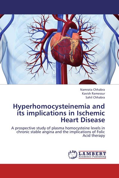 Produktbild: Hyperhomocysteinemia and its implications in Ischemic Heart Disease