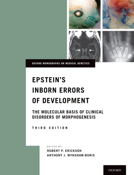 Produktbild: Epstein's Inborn Errors of Development
