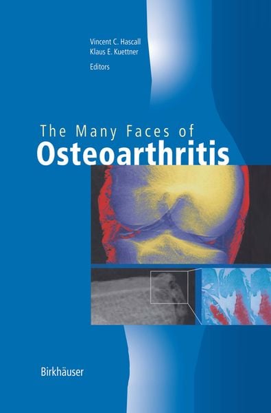 Produktbild: The Many Faces of Osteoarthritis